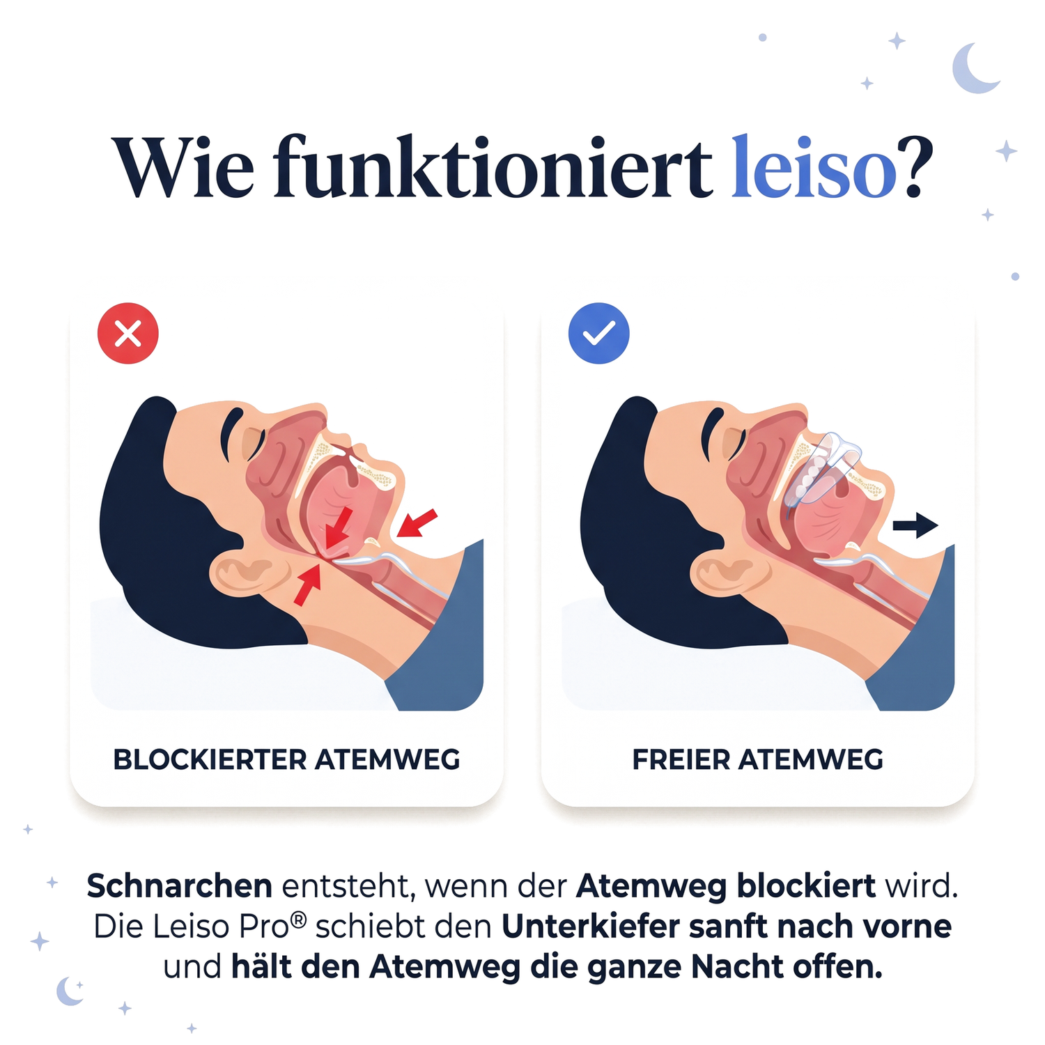Wie funktioniert leiso - blockierter vs freier Atemweg